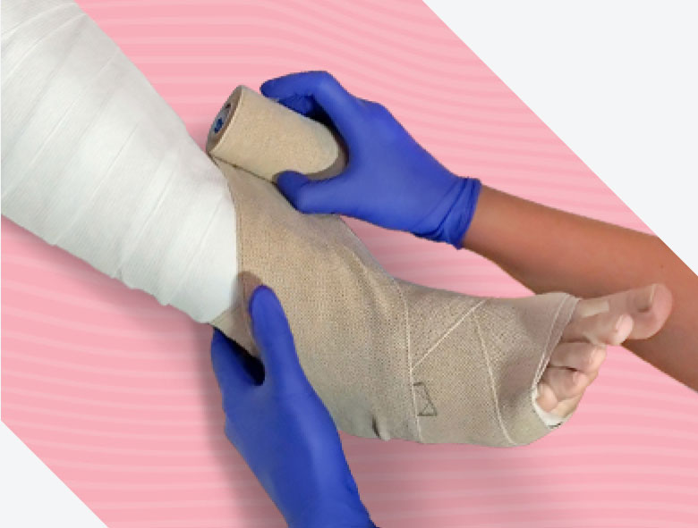 Gloved hands wrapping leg with compression system