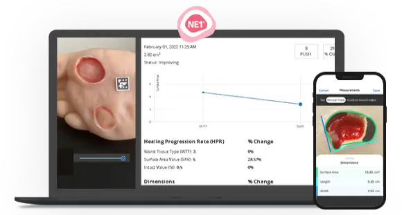 NE1-Wound-Management-System