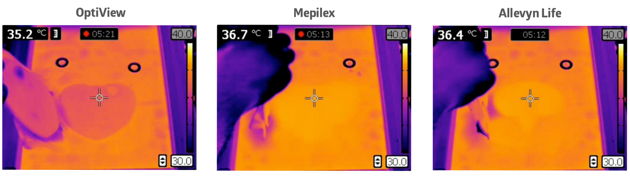 SYM_OptiView_heatmap_RGB Three thermal images showing that OptiView keeps skin cooler than Mepilex or Allevyn Life.