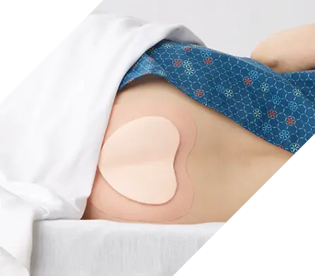 optifoam_desktop_banner Patient lies on side with bordered foam dressing over the sacral area