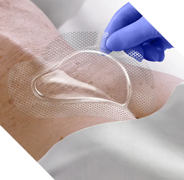 Clinician places OptiView Transparent Dressing with HydroCore Technology on patient’s sacrum