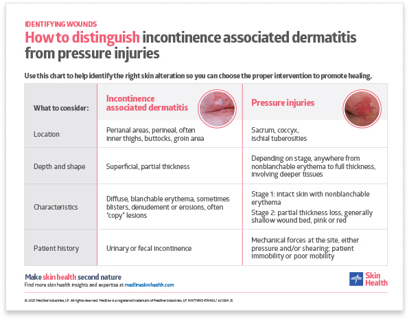 How to distinguish incontinence associated dermatitis from pressure injuries poster thumbnail