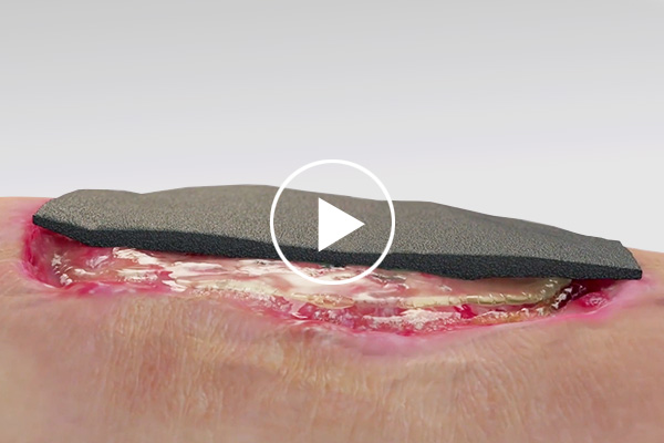 IoPlex mechanisms of action video