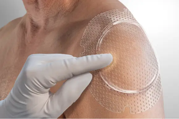 clear-visibility Clinician blanches skin through clear window of dressing