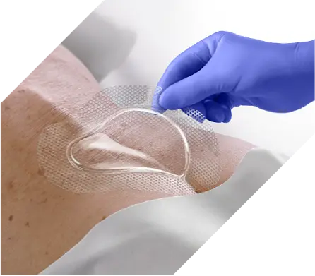 optiview-banner Clinician places OptiView Transparent Dressing with HydroCore Technology on patient’s sacrum