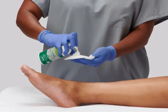 Clinician applies Remedy foaming cleanser to cloth, preparing to cleanse diabetic foot