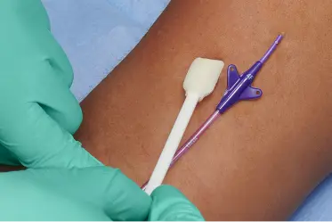 insertion-site A waterproof, skin protecting barrier is applied at the catheter insertion site