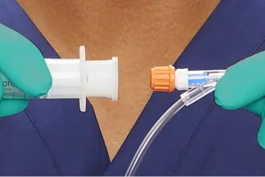 swabcap Image of SwabFlush saline flush syringe with included disinfection cap